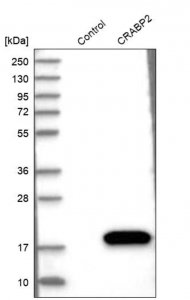 Anti-CRABP2 antibody produced in rabbit 