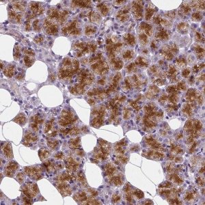 Anti-CRACR2A antibody produced in rabbit 