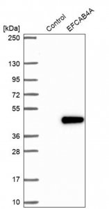 Anti-CRACR2B antibody produced in rabbit 