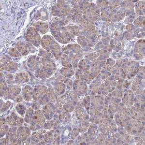Anti-CRACR2B antibody produced in rabbit 