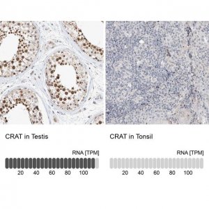 Anti-CRAT antibody produced in rabbit HPA020260-100UL