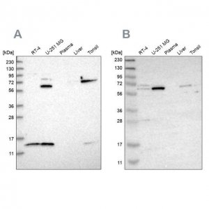 Anti-CRAT antibody produced in rabbit HPA020260-100UL