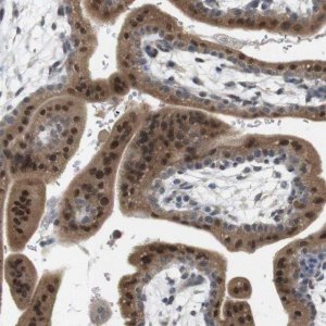 Anti-CREB3L2 antibody produced in rabbit 