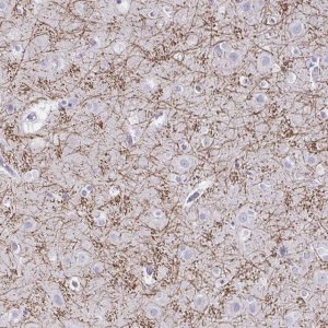 Anti-CREG2 antibody produced in rabbit 