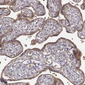 Anti-CRIM1 antibody produced in rabbit 