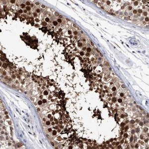 Anti-CRISP2 antibody produced in rabbit 