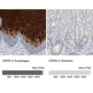 Anti-CRNN antibody produced in rabbit 