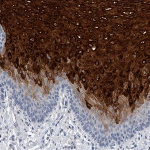 Anti-CRNN antibody produced in rabbit 