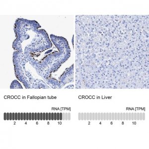 Anti-CROCC antibody produced in rabbit 