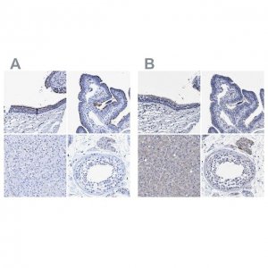 Anti-CROCC antibody produced in rabbit 