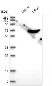 Anti-CROT antibody produced in rabbit 