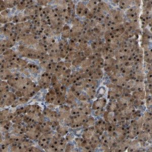 Anti-CROT antibody produced in rabbit 