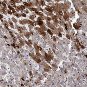 Anti-CRP antibody produced in rabbit 