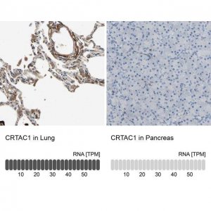 Anti-CRTAC1 antibody produced in rabbit 