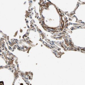 Anti-CRTAC1 antibody produced in rabbit 