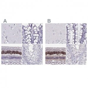 Anti-CRX antibody produced in rabbit 