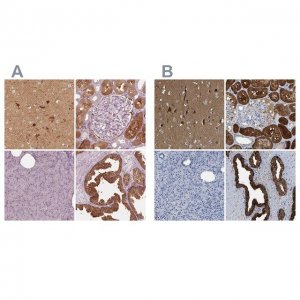 Anti-CRYM antibody produced in rabbit 