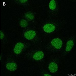 Anti-Cryptochrome-1 Antibody, clone 2C22 ZooMAb Rabbit Monoclonal 