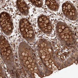 Anti-CRYZL1 antibody produced in rabbit HPA029399-100UL