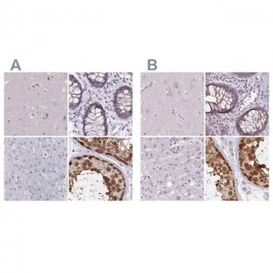 Anti-CSE1L antibody produced in rabbit 