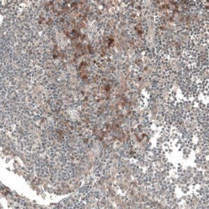Anti-CSF1R antibody produced in rabbit 