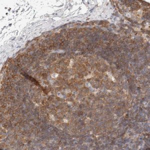 Anti-CSK antibody produced in rabbit 
