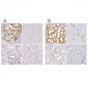 Anti-CSN1S1 antibody produced in rabbit 