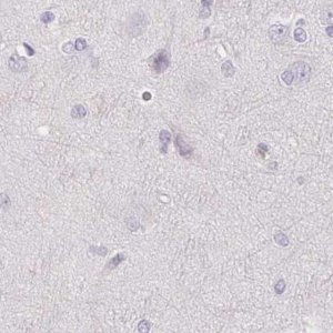 Anti-CSN1S1 antibody produced in rabbit 