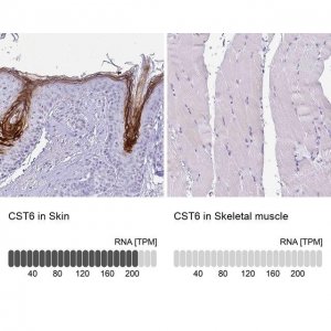 Anti-CST6 antibody produced in rabbit 