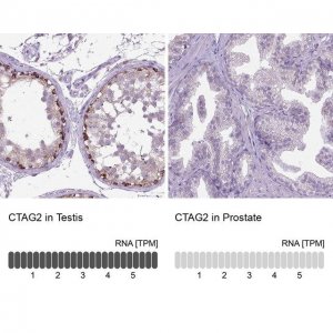 Anti-CTAG2 antibody produced in rabbit 