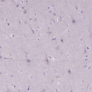 Anti-CTAG2 antibody produced in rabbit 