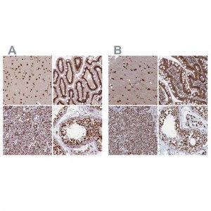 Anti-CTB-50L17.10 antibody produced in rabbit 