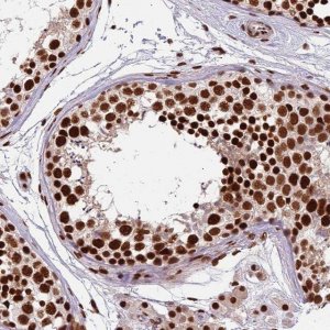 Anti-CTB-50L17.10 antibody produced in rabbit 