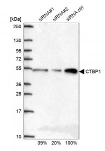 Anti-CTBP1 antibody produced in rabbit 