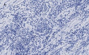 Anti-CTCF antibody, clone 1B18, ZooMAb Rabbit monoclonal 