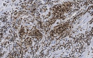 Anti-CTCF antibody, clone 1B18, ZooMAb Rabbit monoclonal 