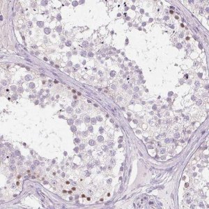Anti-CTCFL antibody produced in rabbit 