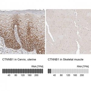 Anti-CTNNB1 antibody produced in rabbit 
