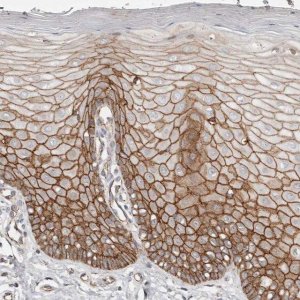 Anti-CTNNB1 antibody produced in rabbit 