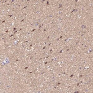 Anti-CTNND2 antibody produced in rabbit 