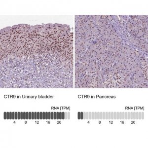 Anti-CTR9 antibody produced in rabbit 