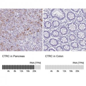 Anti-CTRC antibody produced in rabbit 