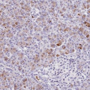 Anti-CTRC antibody produced in rabbit 