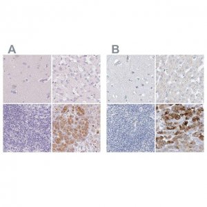 Anti-CTRL antibody produced in rabbit 