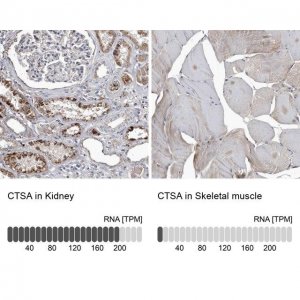 Anti-CTSA antibody produced in rabbit HPA031068-100UL