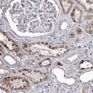 Anti-CTSA antibody produced in rabbit HPA031068-100UL