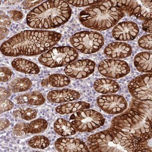 Anti-CTSE antibody produced in rabbit HPA012940-100UL