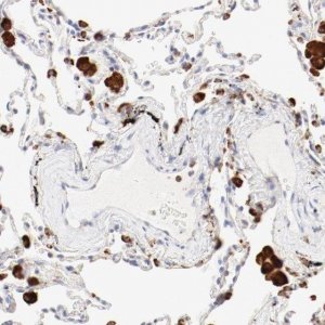 Anti-CTSH antibody produced in rabbit 