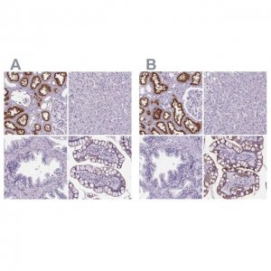 Anti-CUBN antibody produced in rabbit 