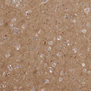 Anti-CUEDC1 antibody produced in rabbit 